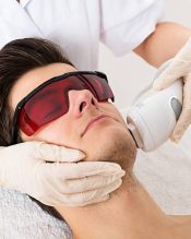 Close-up Of Beautician Giving Laser Epilation Treatment To Young Man Face